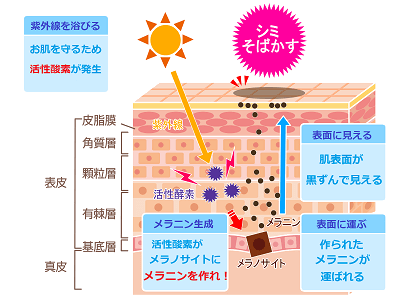 シミが出来るメカニズムのイラスト