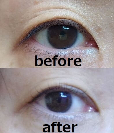 まつ毛パーマ前後の写真