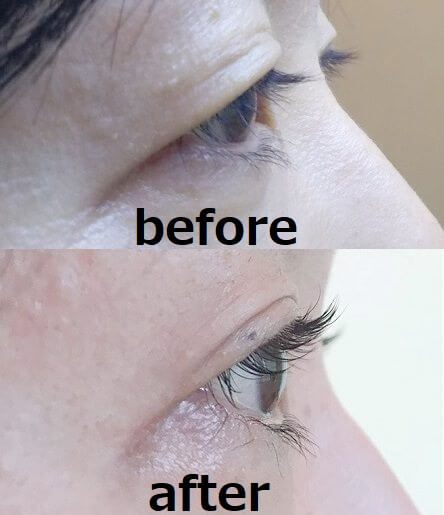 パリジェンヌラッシュリフトの横からの写真