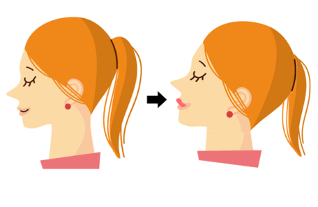 あごと首のたるみケアのイラスト