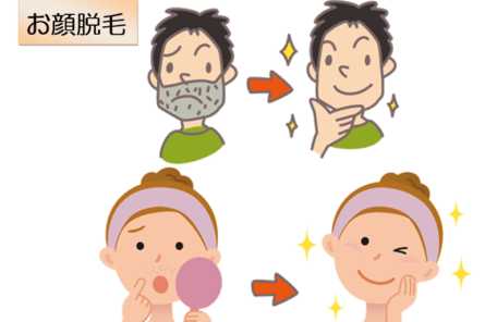 お顔脱毛のイラスト