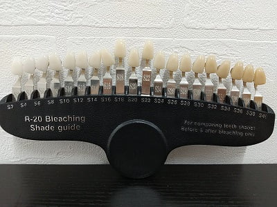 CHOICE霧島本店のセルフホワイトニング1回で白くなった目安の写真