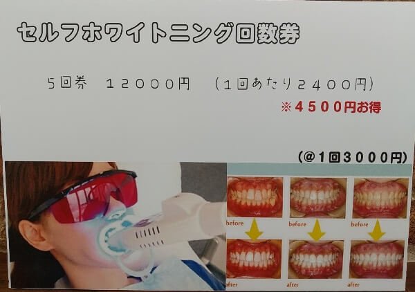 チョイスのセルフホワイトニング回数券の写真