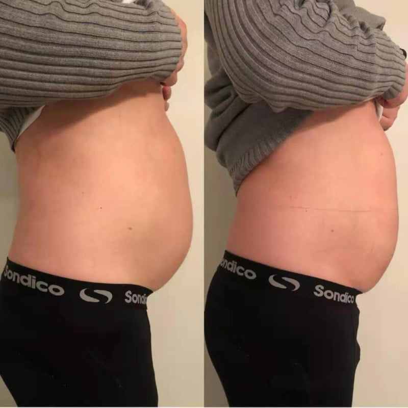 冷却痩身本社モニター画像2