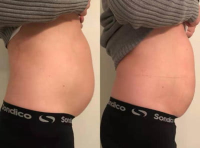 冷却痩身本社モニター画像2