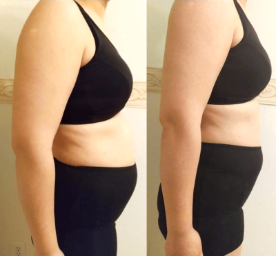 冷却痩身モニター1のb-f画像